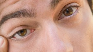 Preventing itchy eyes